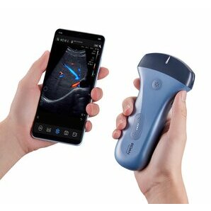 Edan Nano Portable Color Ultrasound